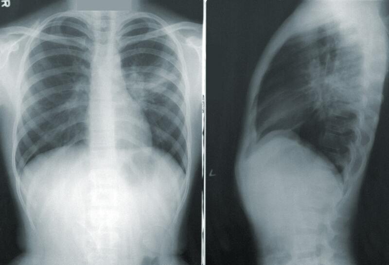 Teleradiologia – innowacja na rynku medycznym